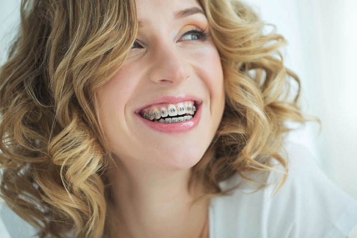 More adults than ever have braces or invisalign - Dr. Thomas C