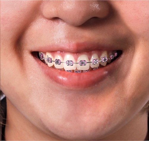 Orthodontist in Thousand Oaks